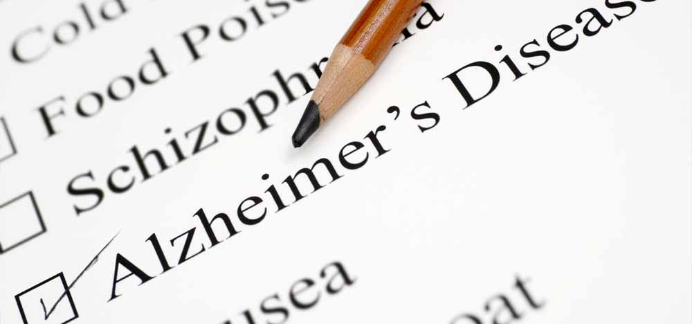 Hiệp Hội Alzheimer's Thuyết Trình Đề Tài 